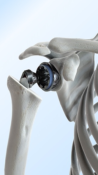 Artificial shoulder joint